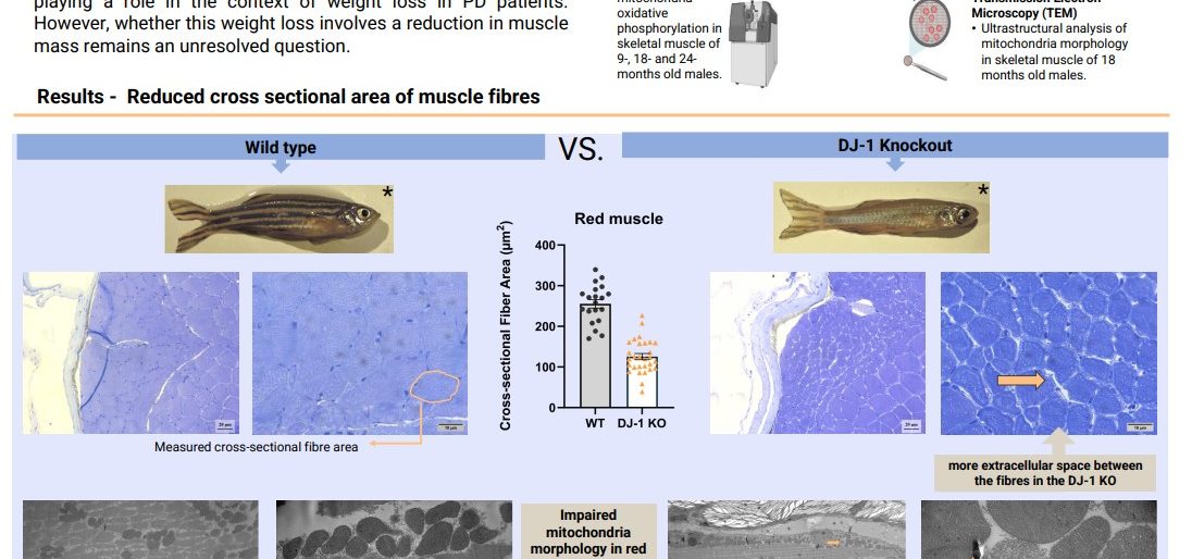 screenshot of the poster entitled "The impact of DJ-1 Deficiency on Skeletal Muscle in Parkinson’s Disease"