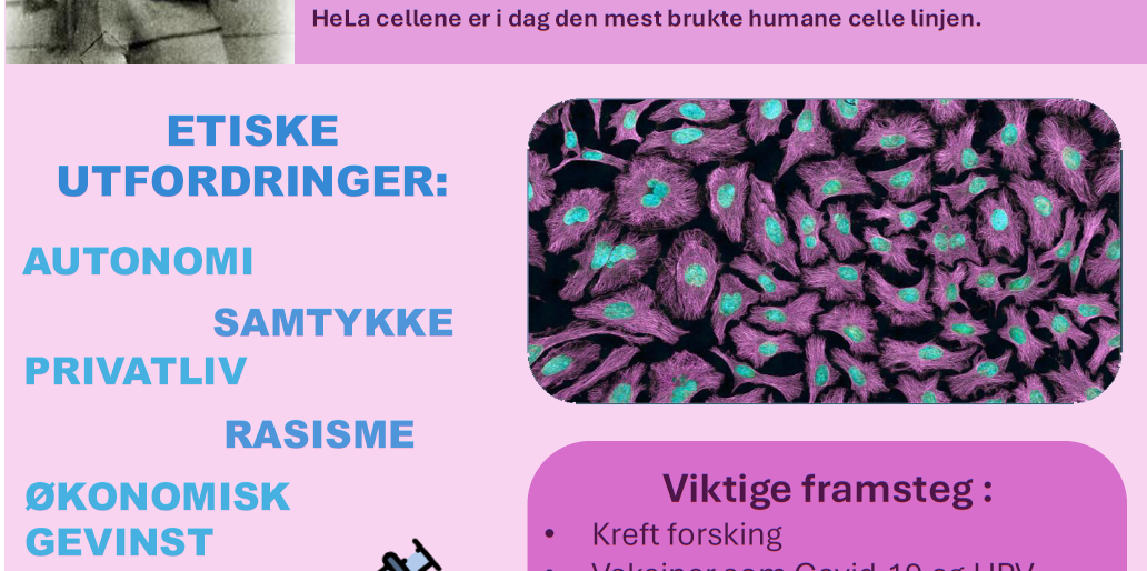 screenshot of the poster entitled Kontroversen bak HeLa cellene: Den første udødelige celle linja